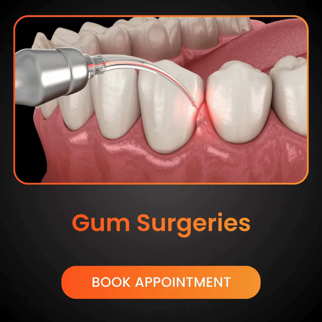 Gum-Surgeries.webp
