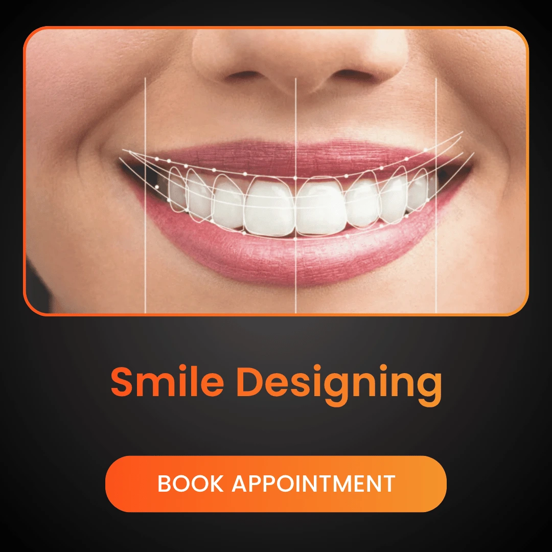 Smile-Designing.webp