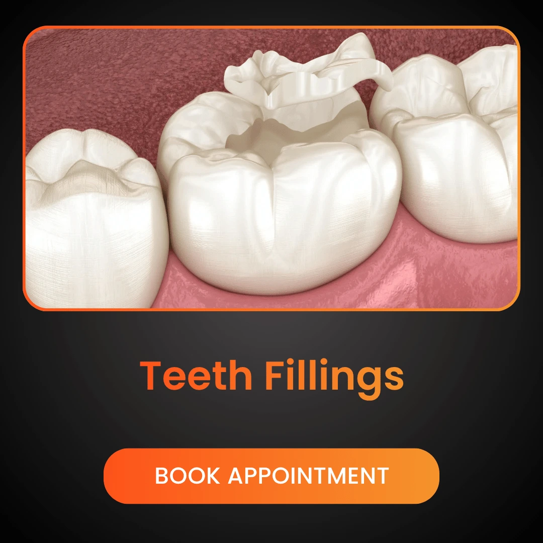 Teeth-Fillings.webp