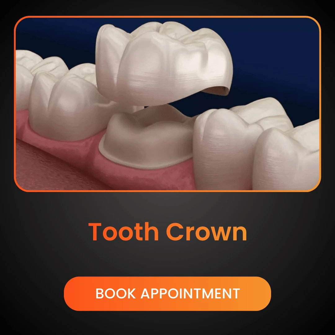 Tooth-Crown.webp